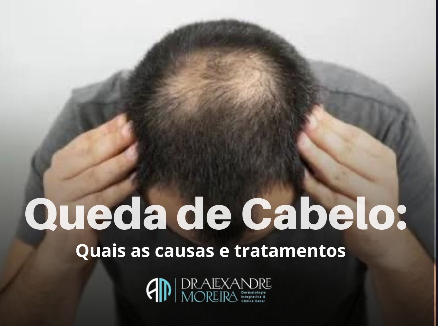 Queda de cabelo