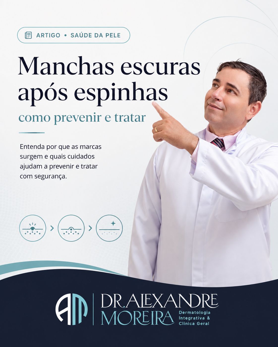 Manchas escuras após espinhas, como prevenir e tratar